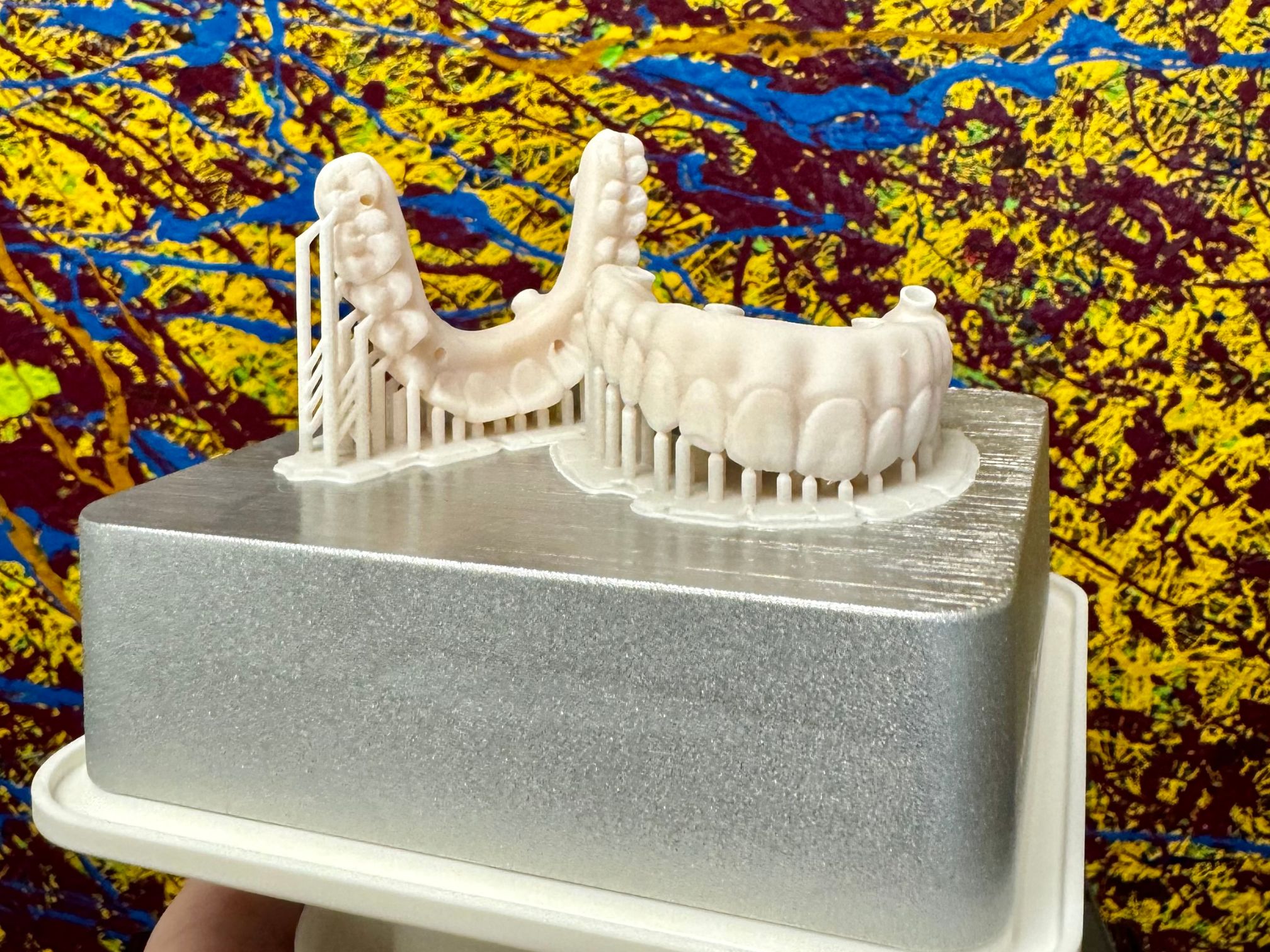 A 3D-printed dental model used in implant education